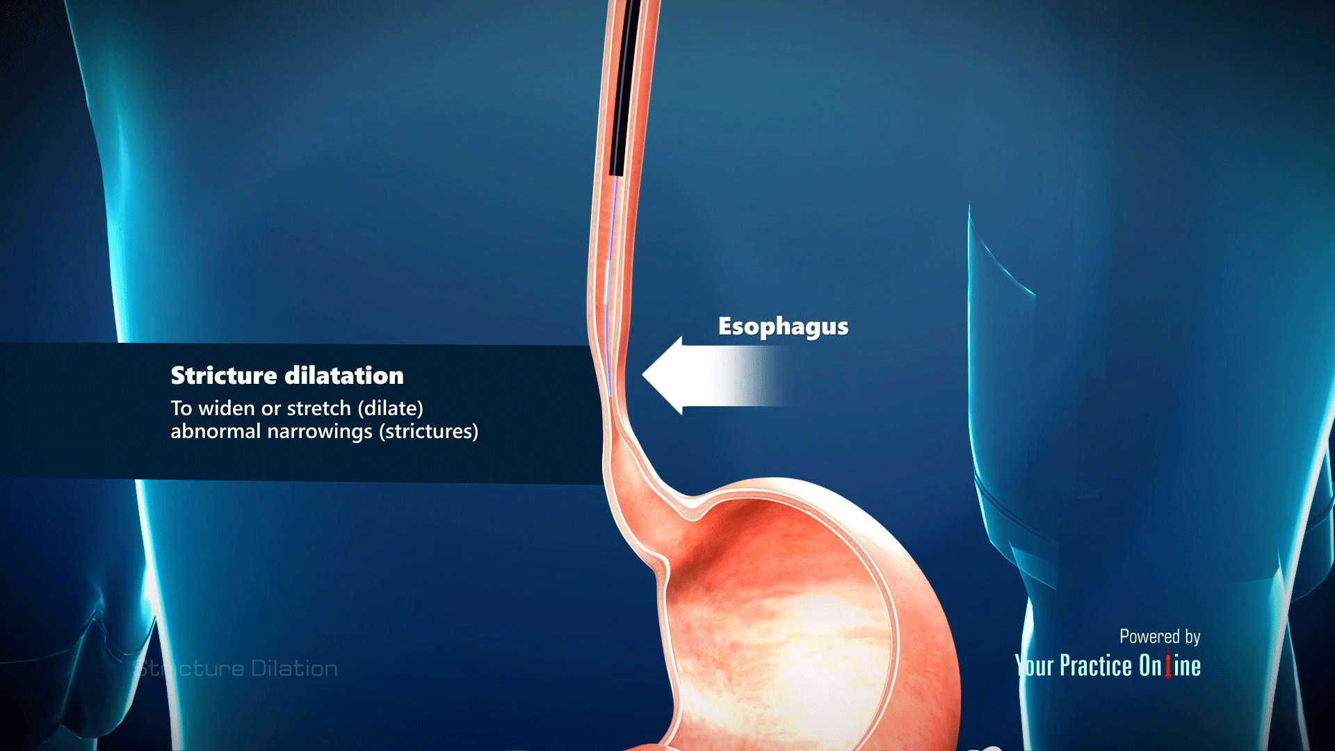 Dialysis Treatments